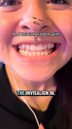 Alex Yoon on Instagram: "#stitch w/ cheermamarn on TT #tldr #longstoryshort"