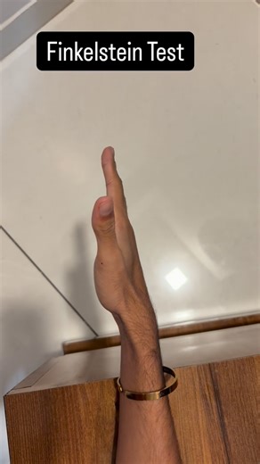 Dipsha Patel on Instagram: "Special Test 5/30 Finkelstein Test Purpose: To diagnose De Quervain’s tenosynovitis — inflammation of the abductor pollicis longus (APL) and extensor pollicis brevis (EPB) tendons of the first dorsal compartment. Procedure: 1.Have the patient make a fist with the thumb tucked inside the fingers. 2.Stabilize the patient’s forearm. 3.Ulnarly deviate (bend toward the pinky side) the patient’s wrist. Positive Test •Sharp pain along the radial side of the wrist, especially