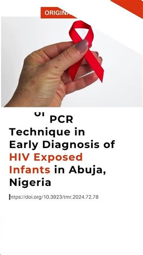 Early HIV Diagnosis in Exposed Infants Using PCR