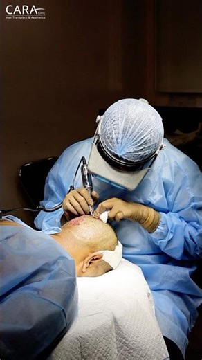 Real Hair Transplant Process You Must See