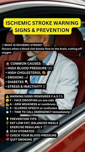 ISCHEMIC STROKE WARNING SIGNS & PREVENTION #healthawareness #stroke #medicaleducation