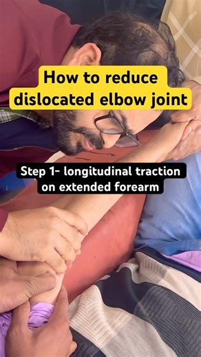 Elbow dislocation reduction #jointpain #jointpainrelief #jointhealth #trauma #orthopedics