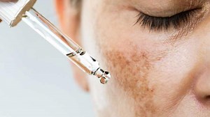 Primele semne și simptome ale cancerului de piele. Cum ne protejăm