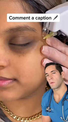 What’s really in her eye?