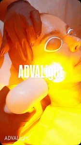 ADVALight, the most versatile vascular laser from Denmark. | Academy of Aesthetics