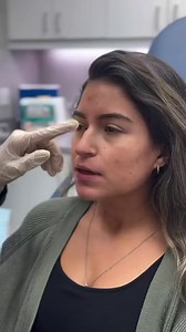 1.3K views | Baby Botox with Julie Teigen , NP ✨ What is it? →...