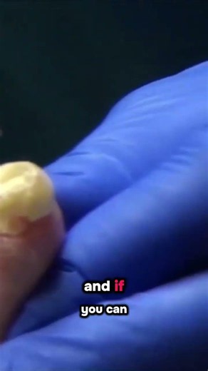 The Most Disgusting Part of a Foot Exam