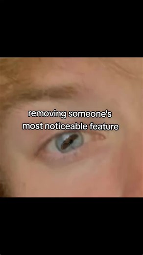 Removing Someone's Most Noticeable Feature prank - Sam and Colby edit
