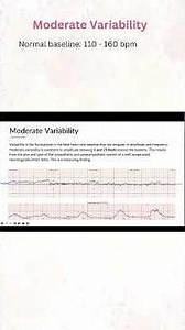 Moderate Variability #fetalmonitoring #fhr #fht #variability #oxygenation #ob #laboranddelivery