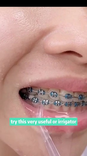 How to make your teeth cleaner?oral irrigator help you!