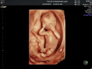 At 14 weeks, most mothers can't feel their babies very well yet, but that doesn't mean those babies aren't moving! This little girl is putting on a show 🥰 | The 4D Ultrasound Lady