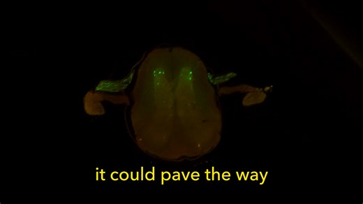 1.2K views | In the quest for a cure for ALS, there’s a new reason for hope. Thanks to new genetic tools, scientists can now target the exact neurons impacted by amyotrophic lateral sclerosis (ALS). These tools give researchers the ability to zero in on these neurons and could provide a way for gene therapies to be delivered. | Allen Institute | Facebook