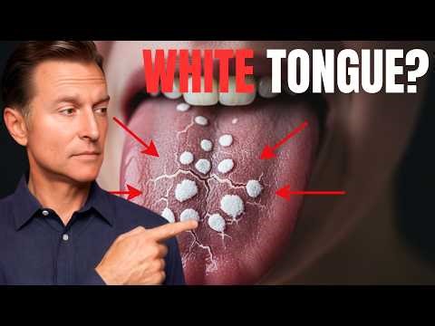 How to Get Rid of Candida in 24 Hours (And Keep It Gone) || Dr. Eric Berg