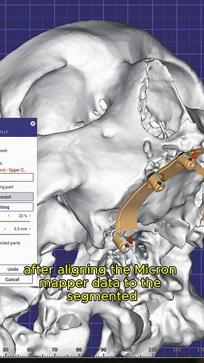 Blake Roney on Instagram: "The MicronMapper Tissue Mapper update is out today! Here is how I recommend setting up your exocad project for Tissue Mapper. Full video on my Youtube. Link in bio."