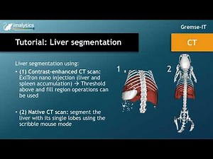 Tutorial video (CT): "Liver segmentation"