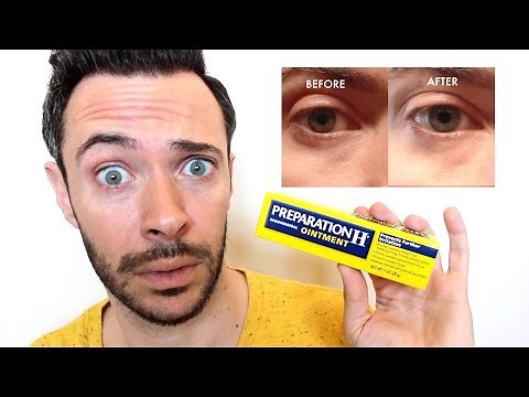 HOW TO GET RID of UNDER EYE BAGS & DARK CIRCLES INSTANTLY w/ PREPARATION H | Does It Really Work?