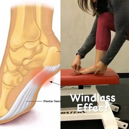 28K views · 50 reactions | Cure heel pain & get your feet summer ready with these great exercises.  | Sole Therapy | Facebook