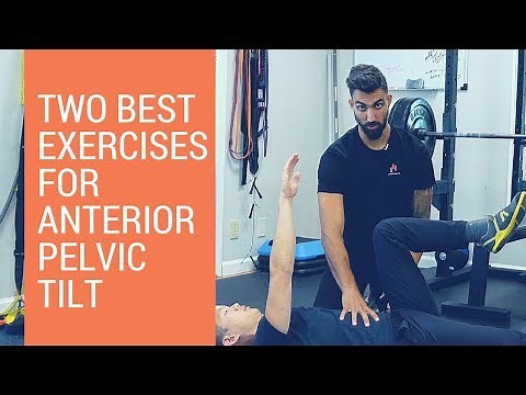 Anterior pelvic tilt correction: the 2 best beginner exercises