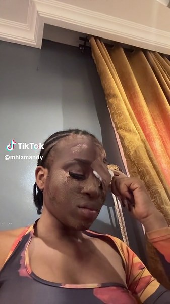 What Happened to Mandy's Face Recently? Explained in Tears 😭