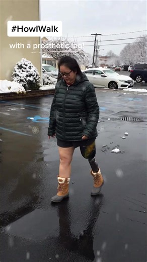 Embracing Life with a Prosthetic Leg