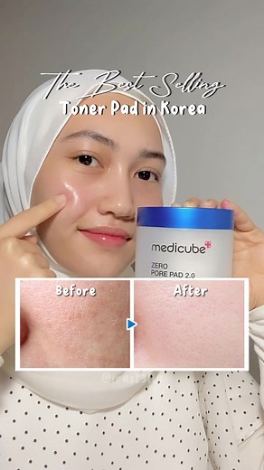 Have been seeing many beauty influencer talking about toner pads lately and i decided to see what's the hype about 👀 Got my hands on the Medicube Zero Pore Pad 2.0 ✨ The toner pads contains : Salicylic Acid (BHA) and AHA (All ingredients help with skin renewal, removing dead skin cells, and unclogging your pores) Both sides on the toner pads have different texture. One side is slightly more bumpy, while the other side of it is smooth. Embossed side: Exfoliate your skin by wiping it across your