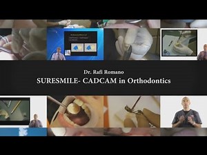 Dr. Rafi Romano - Suresmile CAD/CAM in orthodontics
