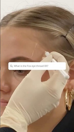 What is the Fox Eye Thread Lift?