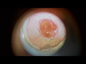 chick embryo at 96 hour in slide under microscope.🧐🧐