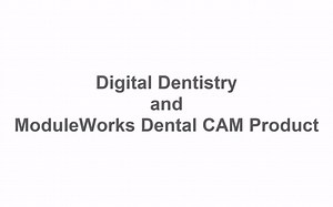 ModuleWorks Dental CAM - 牙科组件