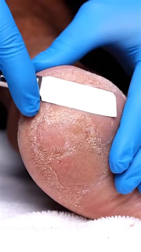 Foot ASMR Spa Clean | Natural Texture Lift CXII #footcare #heeleexfoliation #pedicure #oddlysatisfying #dryskinremoval Enjoy clean, relaxing foot-care ASMR with gentle heel exfoliation and natural callus removal. Disclaimer: AI-generated educational & relaxation content. | Fun Fact