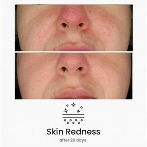Red Algae skincare recovery & repair gel - Anti ageing cream