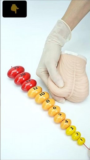 Orchidometer use of orchidometer #nursing