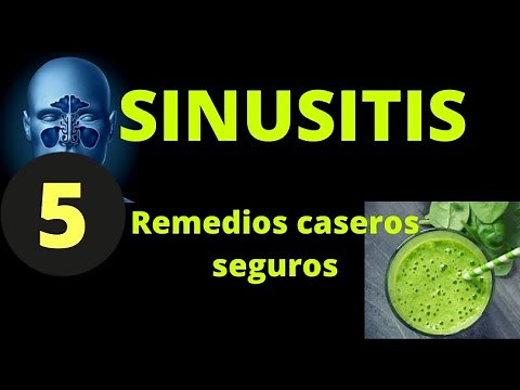 5 SAFE HOME REMEDIES FOR SINUSITIS