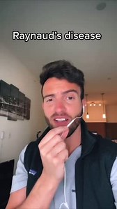 1.3M views · 7.5K reactions | Why your finger can turn completely white | LifeOfADoctor | Facebook