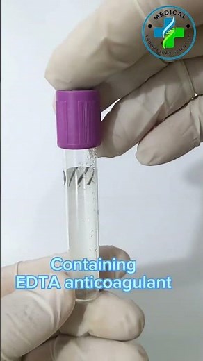 CBC tube | EDTA Anticoagulants | EDTA Vial | CBC test | Blood collection tube | EDTA vacutainer