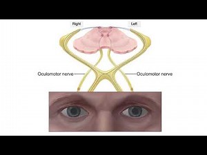 Normal pupillary light reflex