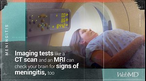 How Meningitis Is Diagnosed