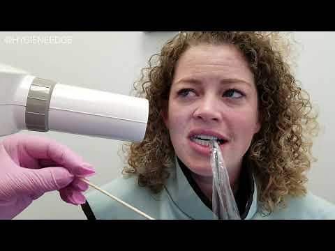 Getting Perfect Horizontal Angulation- Open those contacts