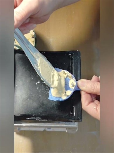 4-Implant Prosthetic Model – Dental Lab Workflow