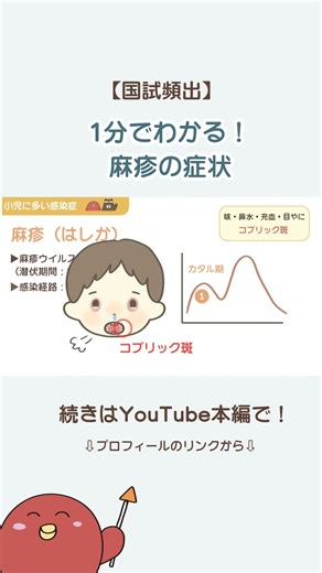 【小児看護】1分でわかる麻疹の症状！コプリック斑と二峰性発熱の罠【国試頻出】