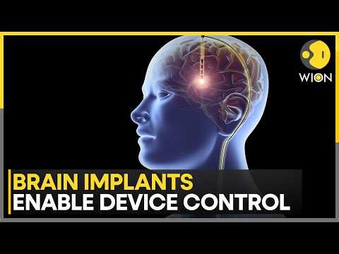 Neuralink Launches First UK Brain Chip Trial: Musk’s Mind-Control Tech Debuts In Britain | WION