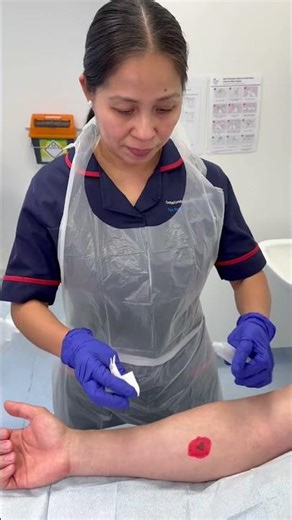 Step 2 – Wound Cleansing | How to dress a wound