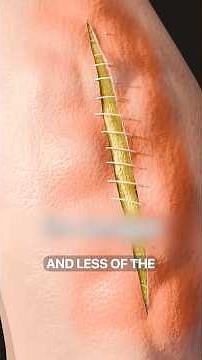 How Stitches Actually Work 😱 Surgeon Reacts