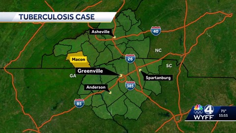 Case of tuberculosis confirmed in Macon County, North Carolina