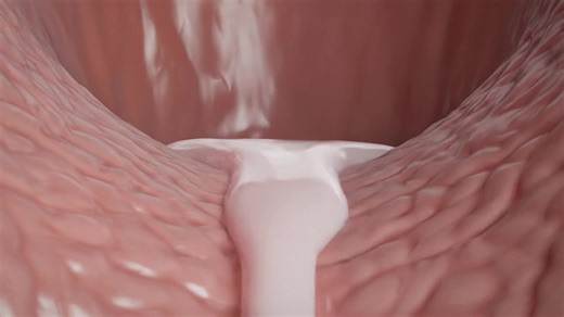 Understanding the Painful Process of Menstruation