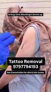 41 reactions | Tattoo Removal at Dr Baigs clinic Allochibagh & Bemina...