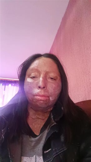 Urgente apoyo para comprar Cicaplast B5 y cremas