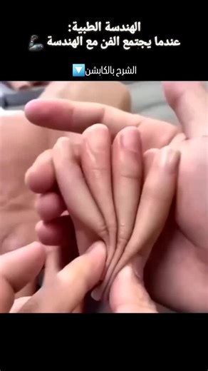 🦾Biomedical Engineering | ‎الظاهر بالفيديو هي أطراف صناعية تجميلية 🦾 مصنوعة من سيليكون طبي مرن تستخدم في بعض الأحيان لغرض تجميلي فقط أو غرض تجميلي ووظيفي بجعلها...‎ | Instagram