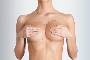 Breast Reduction Surgery - Dr Chris Snijman, Plastic Surgeon