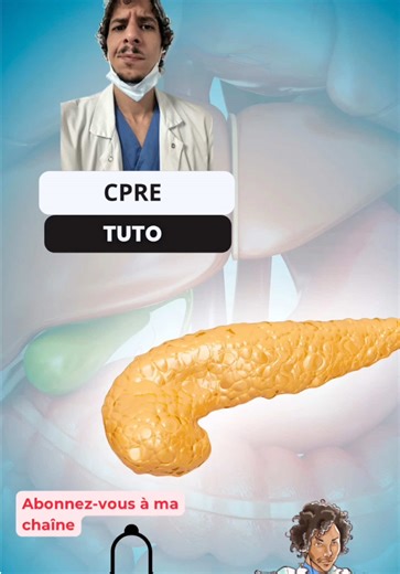 Comprendre prévenir LA CPRE #nurse #tutorial #blood #tips #catheter